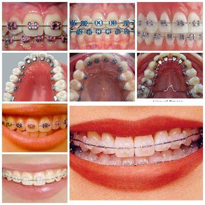 certificate courses orthodontics Delhi